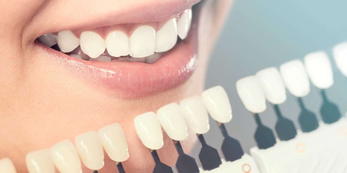 Maintaining Oral Health: The Importance of Teeth Cleaning and Prevention
